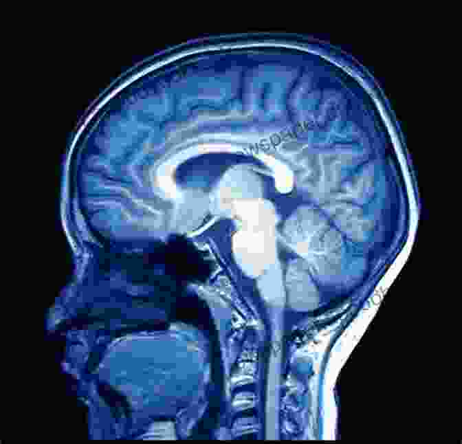 MRI Scan Of A Human Brain Fear Of Jung: The Complex Doctrine And Emotional Science