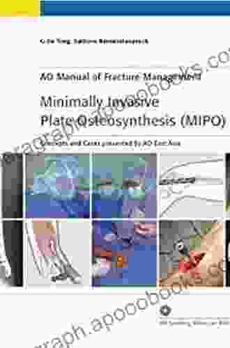 Minimally Invasive Plate Osteosynthesis (MIPO): Concepts And Cases Presented By The AO East Asia (AO Co Publications)