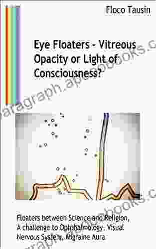 Eye Floaters Vitreous Opacity Or Light Of Consciousness?: Floaters Between Science And Religion A Challenge To Ophthalmology Visual Nervous System Migraine Aura