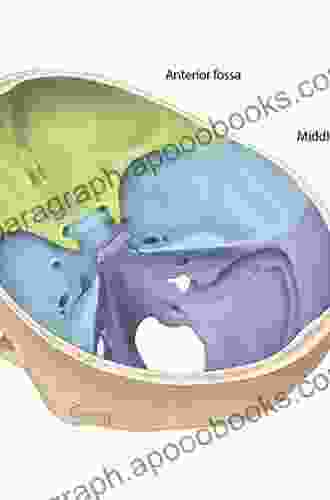 Atlas Of Temporal Bone Surgery