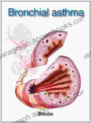 Bronchial Asthma Miniatlas Rod J Rohrich